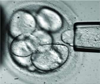 matične ćelije