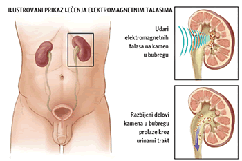Kamen u mokra�nom kanalu